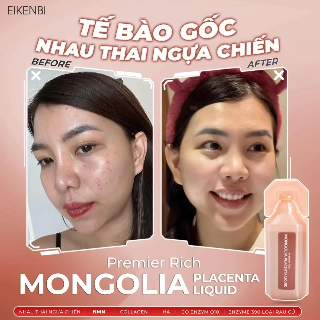 Nước Uống Nhau Thai Ngựa Mông Cổ Premier Rich Mongolia Placenta Liquid