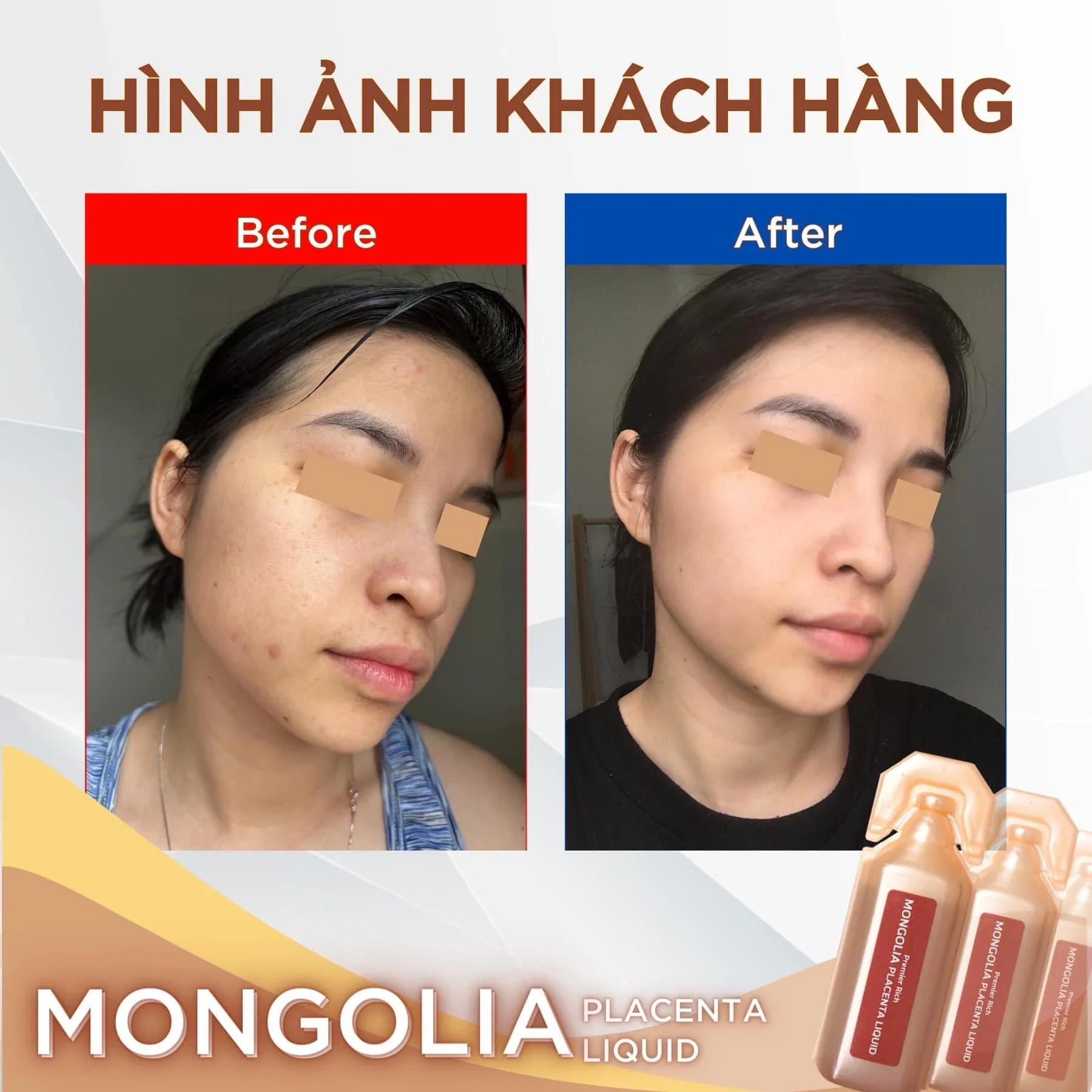 Nước Uống Nhau Thai Ngựa Mông Cổ Premier Rich Mongolia Placenta Liquid