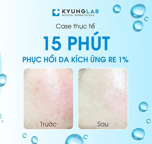 Mặt Nạ KyungLab Bio Hyaluronic Phục Hồi Da