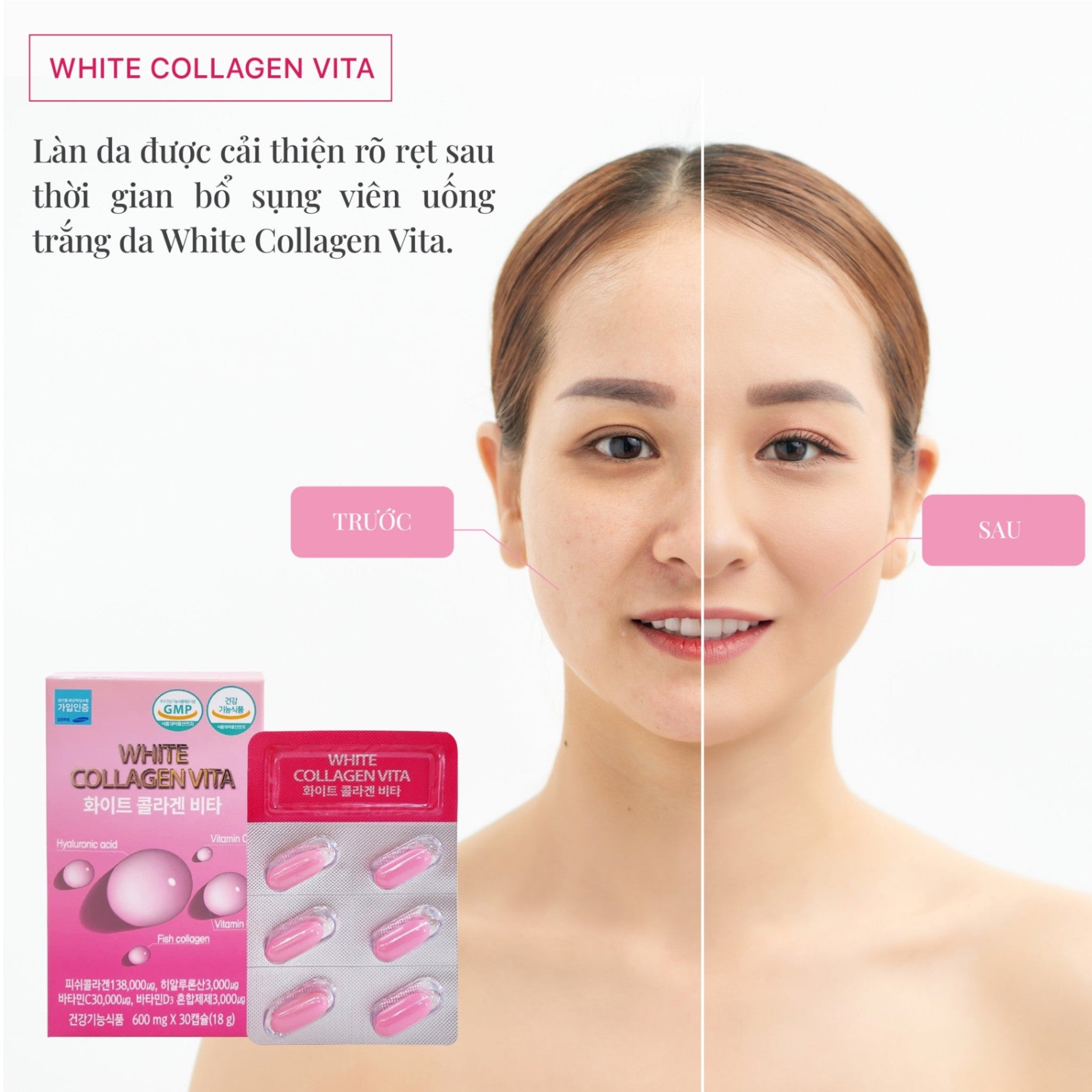 Viên Uống Sáng Da , Giảm Nám White Collagen Vita