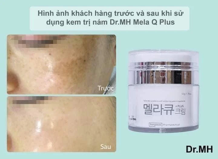 Kem Trị Nám Dr MH Mela Q