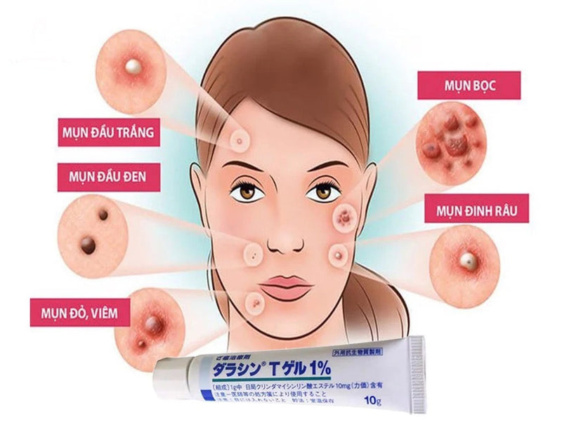 Dalacin T Gel 1% Acne Spot Treatment ( 2 tubes )