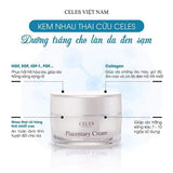 Kem Dưỡng Trắng Ngừa Nám Celes Premium Placentary Cream