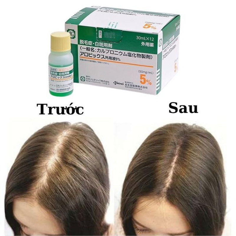 Chosei HairLoss Solution ( May 2023 )
