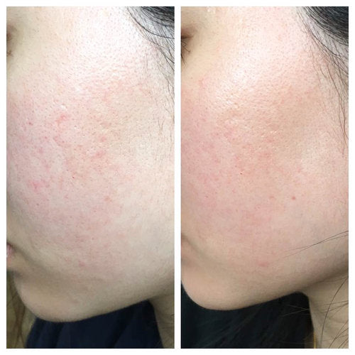 Mặt Nạ Lột Thảo Mộc Sulwhasoo Clarifying Mask