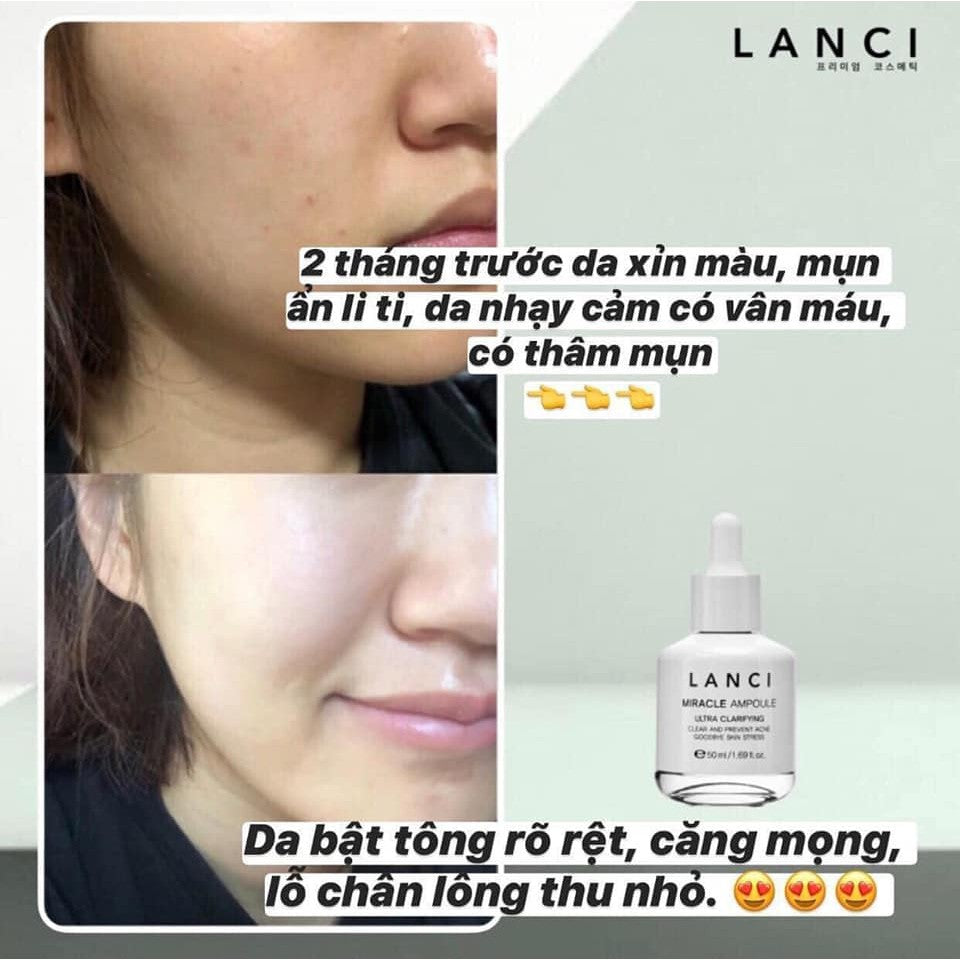 Siêu Serum Lanci Miracle Ampoule - Dưỡng ẩm, giúp làn da sáng khỏe đều màu