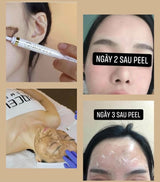BQCell Derma Skin Peeling & Recell cure Ampoule Set