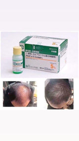 Sato Arovics  Hairloss Solution 5%
