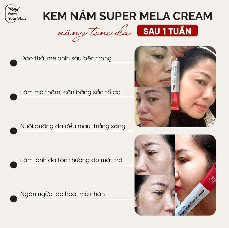 Kem Giảm Thâm Nám Super Mela Cream