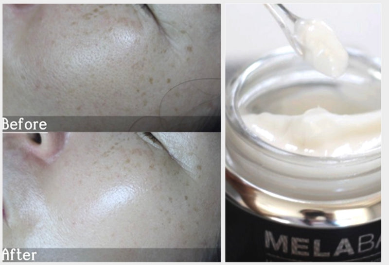 MELABAN Cream Dermo Whitening Formula