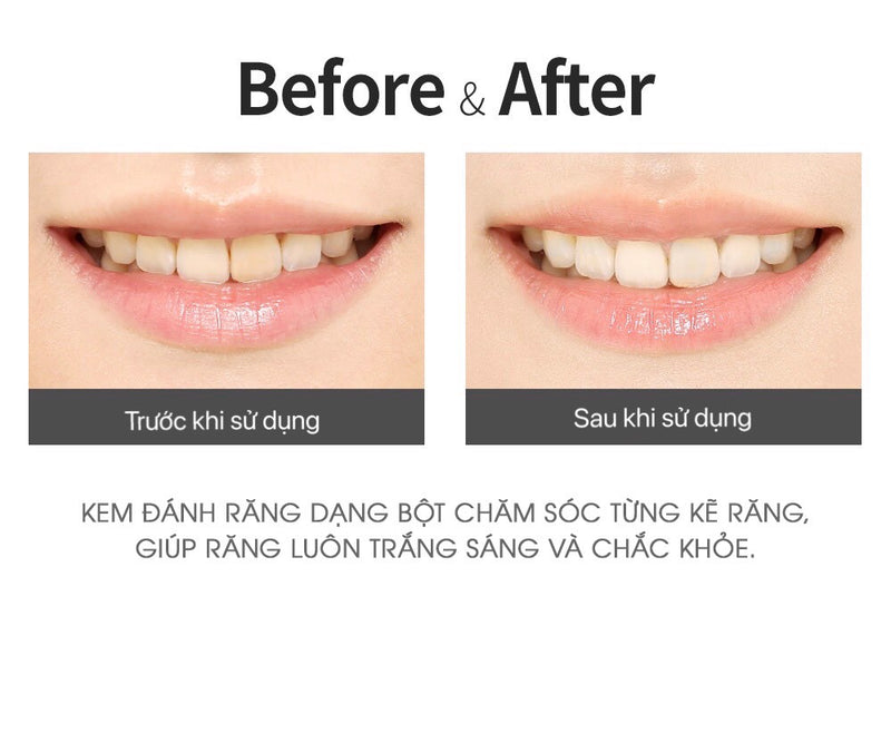 So Natural Bright Tooth Powder - Bột Đánh Răng