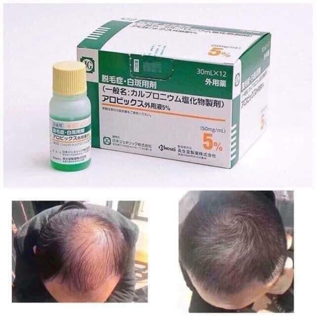 Sato Arovics  Hairloss Solution 5%